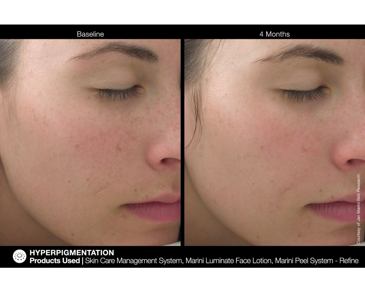 Jan Marini Luminate® Face Lotion