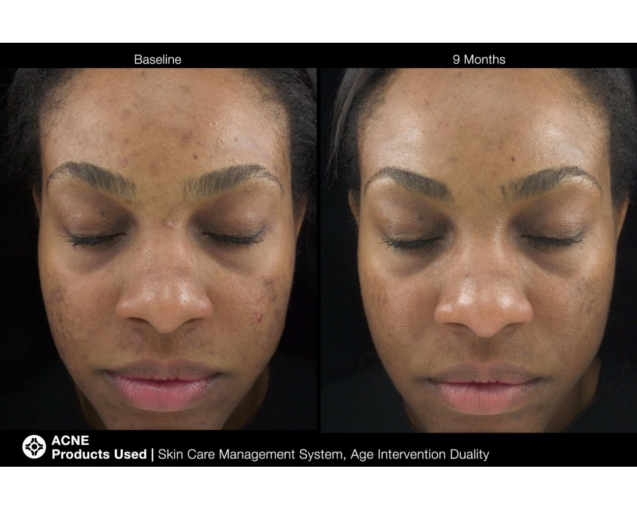 Jan Marini Age Intervention® Duality™