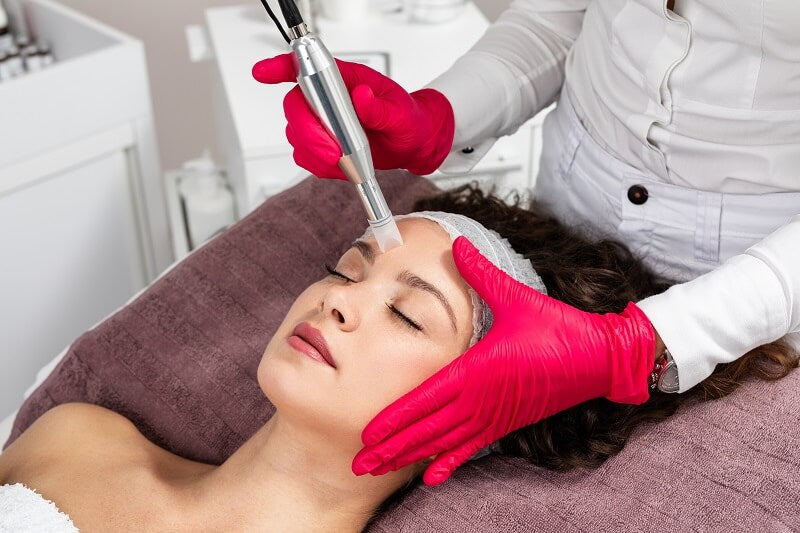 Microneedling with Stem Cells Package of 4